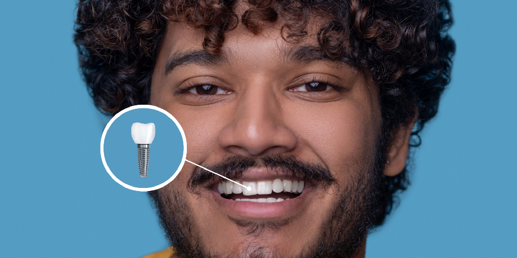 Quanto tempo dura o tratamento de implante dentário?